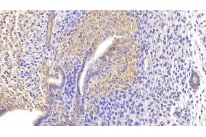 Detection of ITGa1 in Mouse Uterus Tissue using Polyclonal Antibody to Integrin Alpha 1 (ITGa1) (Integrin alpha 1 Antikörper  (AA 103-368))