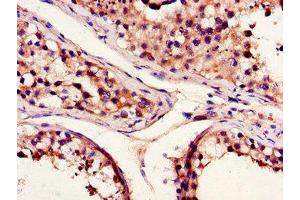 Immunohistochemistry of paraffin-embedded human testis tissue using ABIN7145318 at dilution of 1:100 (BCL2A1 Antikörper  (AA 1-175))
