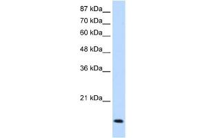 WB Suggested Anti-MYC Antibody Titration:  1. (c-MYC Antikörper  (N-Term))