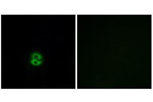 Immunofluorescence (IF) image for anti-Carbohydrate (N-Acetylglucosamine 6-O) Sulfotransferase 6 (CHST6) (C-Term) antibody (ABIN1850996) (CHST6 Antikörper  (C-Term))