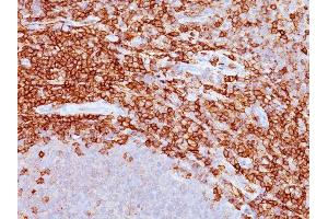 Formalin-fixed, paraffin-embedded human spleen stained with CD43 Mouse Monoclonal Antibody (DF-T1). (CD43 Antikörper)