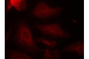Immunofluorescence staining of methanol-fixed Hela cells using Tau(Phospho-Ser404) Antibody. (MAPT Antikörper  (pSer404))