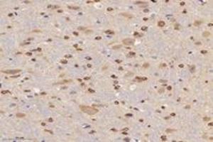 Immunohistochemistry analysis of paraffin-embedded mouse brain using,ABCA7 (ABIN7073146) at dilution of 1: 3000 (ABCA7 Antikörper)