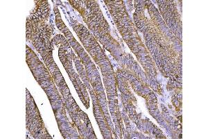 IHC analysis of CTNND1 using anti-CTNND1 antibody (ABIN7602220). (CTNND1 Antikörper  (AA 64-930))