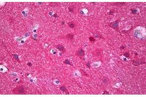 Anti-IRX3 antibody IHC staining of human brain, cortex neurons. (IRX3 Antikörper  (AA 271-320))