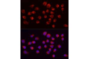 Immunofluorescence analysis of Neuro-2a using ENO2 Rabbit mAb (ABIN7266959) at dilution of 1:100 (40x lens). (ENO2/NSE Antikörper)