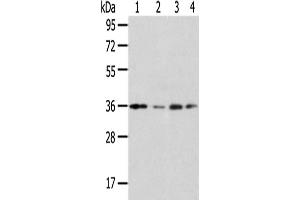 Western Blotting (WB) image for anti-Homeobox D13 (HOXD13) antibody (ABIN5961463) (Homeobox D13 Antikörper)
