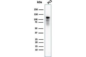 Western Blot Analysis of PC3 cell lysate using Drebrin-1 Mouse Monoclonal Antibody (DBN1/3393). (DBN1 Antikörper  (AA 150-281))