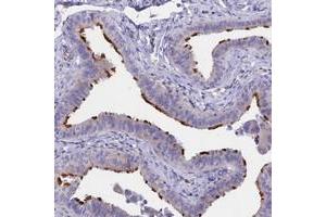 Immunohistochemical staining of human fallopian tube with TMEM138 polyclonal antibody  shows strong membranous positivity in glandular cells.