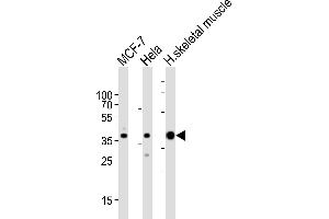 Western blot analysis of lysates from MCF-7, Hela cell line and human skeletal muscle tissue lysate (from left to right), using ALDOA Antibody (C-term) (ABIN389192 and ABIN2839355). (ALDOA Antikörper  (C-Term))