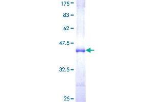 NUP98 Protein (AA 1-110) (GST tag)