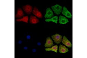 ABIN6265191 and ABIN6273164 staining Hela cells by IF/ICC. (SMOX Antikörper  (Internal Region))