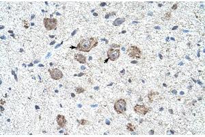 Immunohistochemical staining (Formalin-fixed paraffin-embedded sections) of human brain with KLHL25 polyclonal antibody . (KLHL25 Antikörper  (AA 163-212))