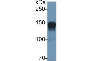 Detection of ORP150 in Human Lung lysate using Polyclonal Antibody to 150 kDa Oxygen Regulated Protein (ORP150) (150 kDa Oxygen Regulated Protein (AA 695-994) Antikörper)