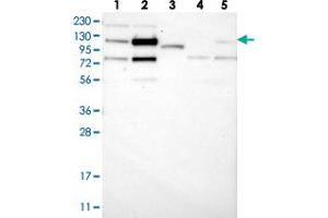 Western blot analysis of Lane 1: RT-4, Lane 2: U-251 MG, Lane 3: Human Plasma, Lane 4: Liver, Lane 5: Tonsil with ZNF592 polyclonal antibody . (ZNF592 Antikörper)