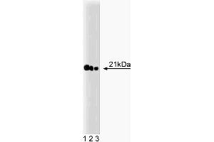 Western blot analysis of Ras on A431 lysate. (RAS Antikörper  (AA 1-190))