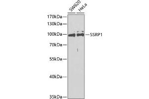 Western blot analysis of extracts of various cell lines, using SSRP1 antibody (ABIN6129536, ABIN6148492, ABIN6148494 and ABIN6217711) at 1:400 dilution. (SSRP1 Antikörper  (AA 1-300))