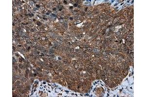 Immunohistochemical staining of paraffin-embedded colon tissue using anti-MTRF1L mouse monoclonal antibody.