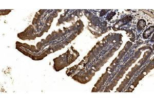 IHC analysis of delta 1 Catenin/CAS/CTNND1 using anti-delta 1 Catenin/CAS/CTNND1 antibody (ABIN7602221). (CTNND1 Antikörper  (AA 64-930))