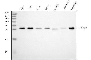 Western blot analysis of TSR2 using anti-TSR2 antibody (ABIN7599035).