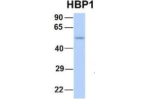 Host:  Rabbit  Target Name:  HBP1  Sample Type:  Human Fetal Lung  Antibody Dilution:  1. (HBP1 Antikörper  (Middle Region))