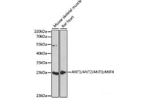 Western blot analysis of extracts of various cell lines using ANT1/ANT2/ANT3/ANT4 Polyclonal Antibody at dilution of 1:1000. (ANT1+ANT2+ANT3+ANT4 Antikörper)