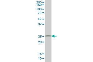 Western Blotting (WB) image for anti-Cell Death-Inducing DFFA-Like Effector B (CIDEB) (AA 3-111) antibody (ABIN599215) (CIDEB Antikörper  (AA 3-111))