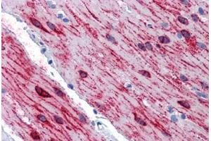 Anti-SLMAP antibody IHC staining of human small intestine, muscularis propria.