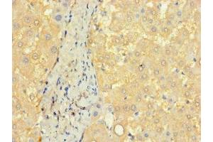 Immunohistochemistry of paraffin-embedded human liver tissue using ABIN7148140 at dilution of 1:100