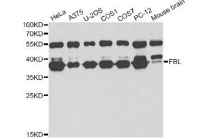 Western blot analysis of extracts of various cell lines, using FBL antibody (ABIN6292110) at 1:1000 dilution. (Fibrillarin Antikörper)