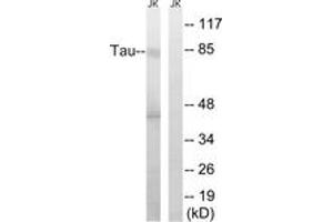 Western blot analysis of extracts from Jurkat cells, using Tau (Ab-519/202) Antibody. (tau Antikörper  (AA 266-315))