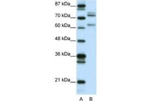 Western Blotting (WB) image for anti-GATA Zinc Finger Domain Containing 2B (GATAD2B) antibody (ABIN2460620) (GATAD2B Antikörper)