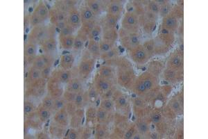 IHC-P analysis of Kidney tissue, with DAB staining. (CROT Antikörper  (AA 410-612))
