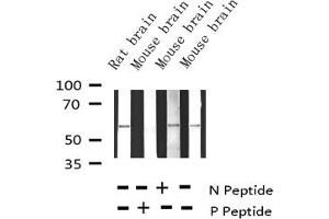Western Blotting (WB) image for anti-Tyrosine Hydroxylase (TH) (pSer31) antibody (ABIN6255191)
