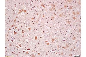 Formalin-fixed and paraffin embedded rat brain labeled with Anti-Rsk2 Polyclonal Antibody, Unconjugated (ABIN700720) at 1:200 followed by conjugation to the secondary antibody and DAB staining (RPS6KA3 Antikörper  (AA 56-160))