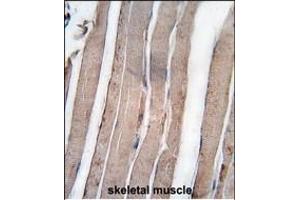 Formalin-fixed and paraffin-embedded human skeletal muscle tissue reacted with DK1 antibody (C-term) 7217b , which was peroxidase-conjugated to the secondary antibody, followed by DAB staining. (DAP Kinase 1 Antikörper  (C-Term))