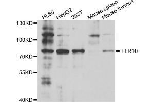 Western blot analysis of extracts of various cell lines, using TLR10 antibody (ABIN5973463) at 1/1000 dilution. (TLR10 Antikörper)