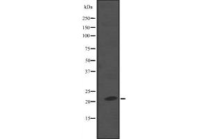 Western blot analysis of NKIRAS2 expression in A549 whole cell lysate ,The lane on the left is treated with the antigen-specific peptide. (NKIRAS2 Antikörper  (C-Term))