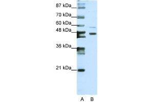 WB Suggested Anti-ZNF558 Antibody Titration:  0. (ZNF558 Antikörper  (N-Term))
