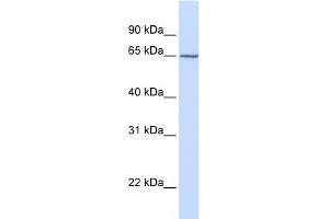 WB Suggested Anti-GALNAC4S-6ST Antibody Titration:  0. (CHST15 Antikörper  (Middle Region))