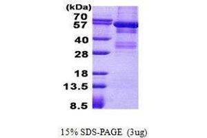 Figure annotation denotes ug of protein loaded and % gel used. (LYN Protein)