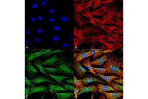 Immunofluorescence (fixed cells) (IF/ICC) image for anti-ATPase, Cu++ Transporting, alpha Polypeptide (ATP7A) (AA 42-61) antibody (Atto 488) (ABIN2485182)