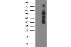 Western Blotting (WB) image for anti-Katanin P80 (WD Repeat Containing) Subunit B 1 (KATNB1) antibody (ABIN1498990) (KATNB1 Antikörper)