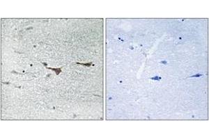 Immunohistochemistry analysis of paraffin-embedded human brain tissue, using TOB1 (Ab-164) Antibody. (Protein Tob1 (TOB1) (AA 130-179) Antikörper)