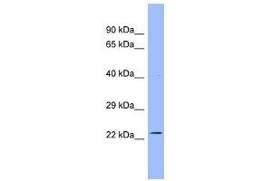 AK3L1 antibody used at 1 ug/ml to detect target protein. (AK4 Antikörper  (N-Term))