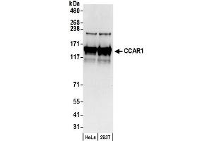 anti-Cell Division Cycle and Apoptosis Regulator 1 (CCAR1) (C-Term) antibody