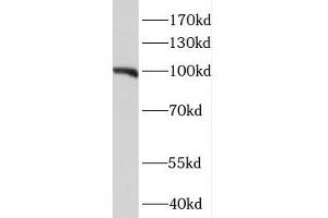 NIH/3T3 cells were subjected to SDS PAGE followed by western blotting (WB) with ABIN7114073 (MEG3 Antibody) at dilution of 1:1000 (MEG3 Antikörper)