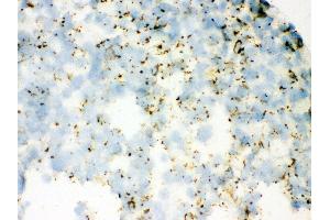 Immunohistochemistry (IHC) image for anti-Surfactant Associated Protein A2 (SFTPA2) (AA 206-237), (C-Term) antibody (ABIN3043922)
