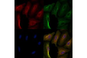 ABIN6257514 and ABIN6276058 staining  cells by IF/ICC. (TACR1 Antikörper  (Internal Region))