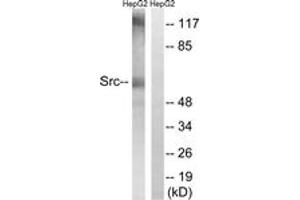 Western blot analysis of extracts from HepG2 cells, using Src (Ab-216) Antibody.